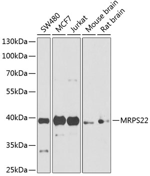 HEK293T cells were transfected with the pCMV6-ENTRY control (Left lane) or pCMV6-ENTRY CSE1L (RC211478, Right lane) cDNA for 48 hrs and lysed. Equivalent amounts of cell lysates (5 ug per lane) were separated by SDS-PAGE and immunoblotted with anti-CSE1L. Positive lysates LY420011 (100 ug) and LC420011 (20 ug) can be purchased separately from OriGene.