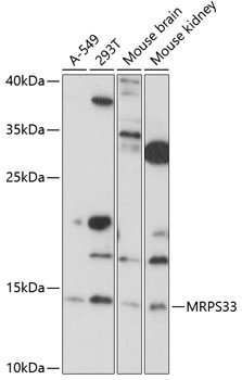 Western blot analysis of extracts of various cell lines, using MRPS33 antibody (TA378682) at 1:1000 dilution. - Secondary antibody: HRP Goat Anti-Rabbit IgG (H+L) at 1:10000 dilution. - Lysates/proteins: 25ug per lane. - Blocking buffer: 3% nonfat dry milk in TBST. - Detection: ECL Basic Kit . - Exposure time: 90s.