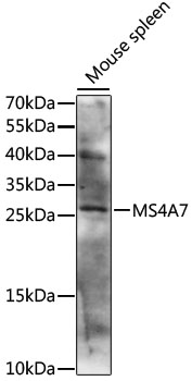 Western blot analysis of extracts of mouse spleen, using MS4A7 antibody (TA378691) at 1:1000 dilution. - Secondary antibody: HRP Goat Anti-Rabbit IgG (H+L) at 1:10000 dilution. - Lysates/proteins: 25ug per lane. - Blocking buffer: 3% nonfat dry milk in TBST. - Detection: ECL Basic Kit . - Exposure time: 10s.