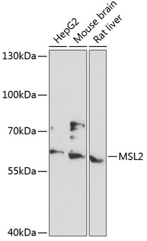 Western blot analysis of extracts of various cell lines, using MSL2 antibody (TA378699) at 1:3000 dilution. - Secondary antibody: HRP Goat Anti-Rabbit IgG (H+L) at 1:10000 dilution. - Lysates/proteins: 25ug per lane. - Blocking buffer: 3% nonfat dry milk in TBST. - Detection: ECL Basic Kit . - Exposure time: 10s.