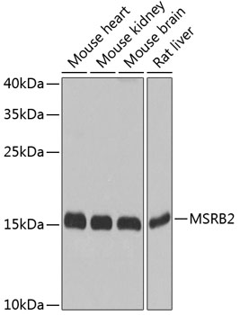 HEK293T cells were transfected with the pCMV6-ENTRY control (Left lane) or pCMV6-ENTRY CD80 (RC206540, Right lane) cDNA for 48 hrs and lysed. Equivalent amounts of cell lysates (5 ug per lane) were separated by SDS-PAGE and immunoblotted with anti-CD80 (1:500).