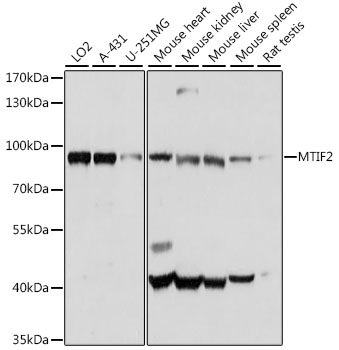 Western blot analysis of extracts of various cell lines, using MTIF2 antibody (TA378751) at 1:1000 dilution. - Secondary antibody: HRP Goat Anti-Rabbit IgG (H+L) at 1:10000 dilution. - Lysates/proteins: 25ug per lane. - Blocking buffer: 3% nonfat dry milk in TBST. - Detection: ECL Basic Kit . - Exposure time: 5s.