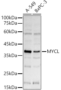 Western blot analysis of extracts of various cell lines, using MYCL antibody (TA378821) at 1:1000 dilution. - Secondary antibody: HRP Goat Anti-Rabbit IgG (H+L) at 1:10000 dilution. - Lysates/proteins: 25ug per lane. - Blocking buffer: 3% nonfat dry milk in TBST. - Detection: ECL Basic Kit . - Exposure time: 3s.