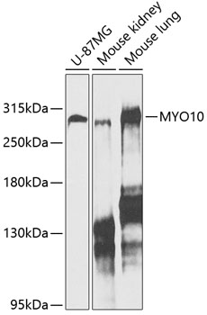 Western blot analysis of extracts of various cell lines, using MYO10 antibody (TA378863) at 1:1000 dilution. - Secondary antibody: HRP Goat Anti-Rabbit IgG (H+L) at 1:10000 dilution. - Lysates/proteins: 25ug per lane. - Blocking buffer: 3% nonfat dry milk in TBST. - Detection: ECL Enhanced Kit . - Exposure time: 20s.
