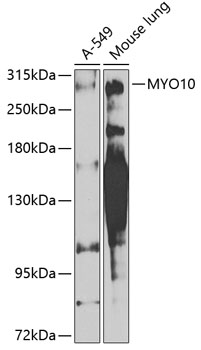 Western blot analysis of extracts of various cell lines, using MYO10 antibody (TA378864) at 1:1000 dilution. - Secondary antibody: HRP Goat Anti-Rabbit IgG (H+L) at 1:10000 dilution. - Lysates/proteins: 25ug per lane. - Blocking buffer: 3% nonfat dry milk in TBST. - Detection: ECL Enhanced Kit . - Exposure time: 90s.