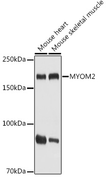 Western blot analysis of extracts of various cell lines, using MYOM2 antibody (TA378882) at 1:1000 dilution. - Secondary antibody: HRP Goat Anti-Rabbit IgG (H+L) at 1:10000 dilution. - Lysates/proteins: 25ug per lane. - Blocking buffer: 3% nonfat dry milk in TBST. - Detection: ECL Basic Kit . - Exposure time: 1s.