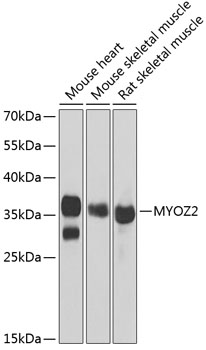 Western blot analysis of extracts of various cell lines, using MYOZ2 antibody (TA378884) at 1:1000 dilution. - Secondary antibody: HRP Goat Anti-Rabbit IgG (H+L) at 1:10000 dilution. - Lysates/proteins: 25ug per lane. - Blocking buffer: 3% nonfat dry milk in TBST. - Detection: ECL Basic Kit . - Exposure time: 10s.