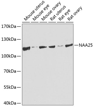Western blot analysis of extracts of various cell lines, using NAA25 antibody (TA378900) at 1:1000 dilution. - Secondary antibody: HRP Goat Anti-Rabbit IgG (H+L) at 1:10000 dilution. - Lysates/proteins: 25ug per lane. - Blocking buffer: 3% nonfat dry milk in TBST. - Detection: ECL Basic Kit . - Exposure time: 60s.