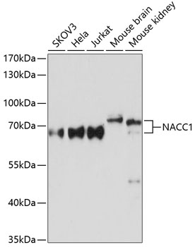 Western blot analysis of extracts of various cell lines, using NACC1 Antibody (TA378909) at 1:3000 dilution. - Secondary antibody: HRP Goat Anti-Rabbit IgG (H+L) at 1:10000 dilution. - Lysates/proteins: 25ug per lane. - Blocking buffer: 3% nonfat dry milk in TBST. - Detection: ECL Basic Kit . - Exposure time: 10s.
