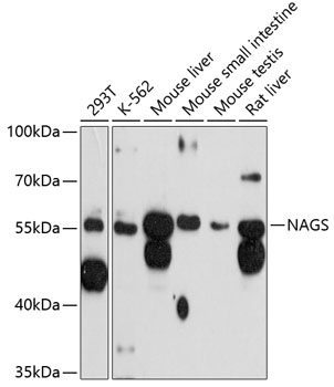 Western blot analysis of extracts of various cell lines, using NAGS antibody (TA378915) at 1:3000 dilution. - Secondary antibody: HRP Goat Anti-Rabbit IgG (H+L) at 1:10000 dilution. - Lysates/proteins: 25ug per lane. - Blocking buffer: 3% nonfat dry milk in TBST. - Detection: ECL Basic Kit . - Exposure time: 90s.