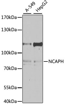Western blot analysis of extracts of various cell lines, using NCAPH antibody (TA378951) at 1:1000 dilution. - Secondary antibody: HRP Goat Anti-Rabbit IgG (H+L) at 1:10000 dilution. - Lysates/proteins: 25ug per lane. - Blocking buffer: 3% nonfat dry milk in TBST. - Detection: ECL Enhanced Kit . - Exposure time: 60s.