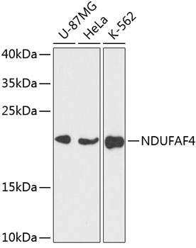 Western blot analysis of extracts of various cell lines, using NDUFAF4 antibody (TA379005) at 1:3000 dilution. - Secondary antibody: HRP Goat Anti-Rabbit IgG (H+L) at 1:10000 dilution. - Lysates/proteins: 25ug per lane. - Blocking buffer: 3% nonfat dry milk in TBST. - Detection: ECL Enhanced Kit . - Exposure time: 30s.