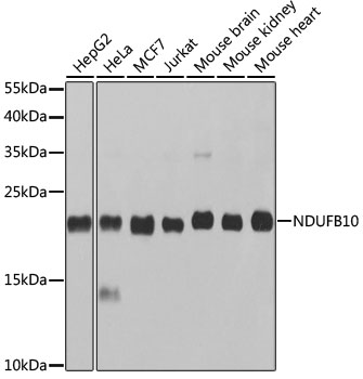 Western blot analysis of extracts of various cell lines, using NDUFB10 antibody (TA379008) at 1:1000 dilution. - Secondary antibody: HRP Goat Anti-Rabbit IgG (H+L) at 1:10000 dilution. - Lysates/proteins: 25ug per lane. - Blocking buffer: 3% nonfat dry milk in TBST. - Detection: ECL Basic Kit . - Exposure time: 10s.