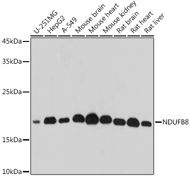 Western blot analysis of extracts of various cell lines, using NDUFB8 antibody (TA379016) at 1:500 dilution. - Secondary antibody: HRP Goat Anti-Rabbit IgG (H+L) at 1:10000 dilution. - Lysates/proteins: 25ug per lane. - Blocking buffer: 3% nonfat dry milk in TBST. - Detection: ECL Basic Kit . - Exposure time: 10s.