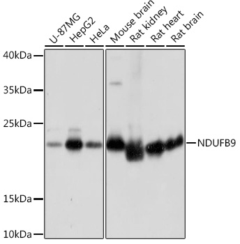 Western blot analysis of extracts of various cell lines, using NDUFB9 Rabbit pAb (TA379017) at 1:1000 dilution. - Secondary antibody: HRP Goat Anti-Rabbit IgG (H+L) at 1:10000 dilution. - Lysates/proteins: 25ug per lane. - Blocking buffer: 3% nonfat dry milk in TBST. - Detection: ECL Basic Kit . - Exposure time: 1s.