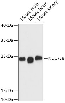 Western blot analysis of extracts of various cell lines, using NDUFS8 antibody (TA379025) at 1:3000 dilution. - Secondary antibody: HRP Goat Anti-Rabbit IgG (H+L) at 1:10000 dilution. - Lysates/proteins: 25ug per lane. - Blocking buffer: 3% nonfat dry milk in TBST. - Detection: ECL Basic Kit . - Exposure time: 90s.