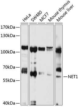 Western blot analysis of extracts of various cell lines, using NET1 antibody (TA379059) at 1:1000 dilution. - Secondary antibody: HRP Goat Anti-Rabbit IgG (H+L) at 1:10000 dilution. - Lysates/proteins: 25ug per lane. - Blocking buffer: 3% nonfat dry milk in TBST. - Detection: ECL Basic Kit . - Exposure time: 15s.