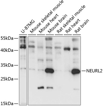 HEK293T cells were transfected with the pCMV6-ENTRY control (Cat# PS100001, Left lane) or pCMV6-ENTRY CSTB (Cat# RC203872, Right lane) cDNA for 48 hrs and lysed. Equivalent amounts of cell lysates (5 ug per lane) were separated by SDS-PAGE and immunoblotted with anti-CSTB (Cat# TA813050)(1:500). Positive lysates [LY424918] (100 ug) and [LC424918] (20 ug) can be purchased separately from OriGene.