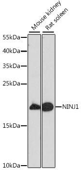 Western blot analysis of extracts of various cell lines, using NINJ1 antibody (TA379132) at 1:1000 dilution. - Secondary antibody: HRP Goat Anti-Rabbit IgG (H+L) at 1:10000 dilution. - Lysates/proteins: 25ug per lane. - Blocking buffer: 3% nonfat dry milk in TBST. - Detection: ECL Basic Kit . - Exposure time: 10s.