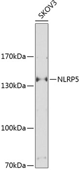 Western blot analysis of extracts of SKOV3 cells, using NLRP5 Antibody (TA379168) at 1:1000 dilution. - Secondary antibody: HRP Goat Anti-Rabbit IgG (H+L) at 1:10000 dilution. - Lysates/proteins: 25ug per lane. - Blocking buffer: 3% nonfat dry milk in TBST. - Detection: ECL Basic Kit . - Exposure time: 20S.