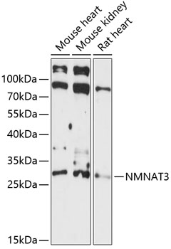 Western blot analysis of extracts of various cell lines, using NMNAT3 antibody (TA379183) at 1:3000 dilution. - Secondary antibody: HRP Goat Anti-Rabbit IgG (H+L) at 1:10000 dilution. - Lysates/proteins: 25ug per lane. - Blocking buffer: 3% nonfat dry milk in TBST. - Detection: ECL Basic Kit . - Exposure time: 90s.
