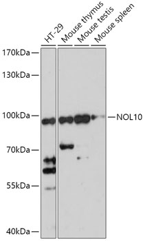 Western blot analysis of extracts of various cell lines, using NOL10 antibody (TA379199) at 1:1000 dilution. - Secondary antibody: HRP Goat Anti-Rabbit IgG (H+L) at 1:10000 dilution. - Lysates/proteins: 25ug per lane. - Blocking buffer: 3% nonfat dry milk in TBST. - Detection: ECL Basic Kit . - Exposure time: 1s.
