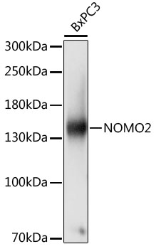 Western blot analysis of extracts of BxPC3 cells, using NOMO2 antibody (TA379207) at 1:1000 dilution. - Secondary antibody: HRP Goat Anti-Rabbit IgG (H+L) at 1:10000 dilution. - Lysates/proteins: 25ug per lane. - Blocking buffer: 3% nonfat dry milk in TBST. - Detection: ECL Basic Kit . - Exposure time: 1s.