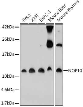 Western blot analysis of extracts of various cell lines, using NOP10 antibody (TA379208) at 1:1000 dilution. - Secondary antibody: HRP Goat Anti-Rabbit IgG (H+L) at 1:10000 dilution. - Lysates/proteins: 25ug per lane. - Blocking buffer: 3% nonfat dry milk in TBST. - Detection: ECL Basic Kit . - Exposure time: 3min.