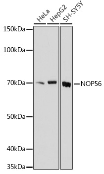 Western blot analysis of extracts of various cell lines, using NOP56 Rabbit pAb (TA379213) at 1:1000 dilution. - Secondary antibody: HRP Goat Anti-Rabbit IgG (H+L) at 1:10000 dilution. - Lysates/proteins: 25ug per lane. - Blocking buffer: 3% nonfat dry milk in TBST. - Detection: ECL Basic Kit . - Exposure time: 180s.