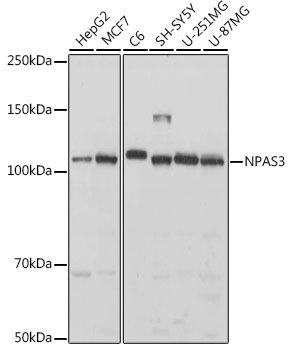 Western blot analysis of extracts of various cell lines, using NPAS3 antibody (TA379246) at 1:1000 dilution. - Secondary antibody: HRP Goat Anti-Rabbit IgG (H+L) at 1:10000 dilution. - Lysates/proteins: 25ug per lane. - Blocking buffer: 3% nonfat dry milk in TBST. - Detection: ECL Basic Kit . - Exposure time: 1s.