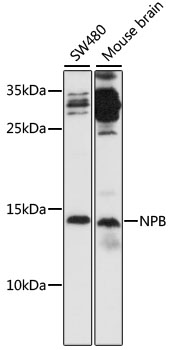 Western blot analysis of extracts of various cell lines, using NPB antibody (TA379247) at 1:1000 dilution. - Secondary antibody: HRP Goat Anti-Rabbit IgG (H+L) at 1:10000 dilution. - Lysates/proteins: 25ug per lane. - Blocking buffer: 3% nonfat dry milk in TBST. - Detection: ECL Basic Kit . - Exposure time: 90s.