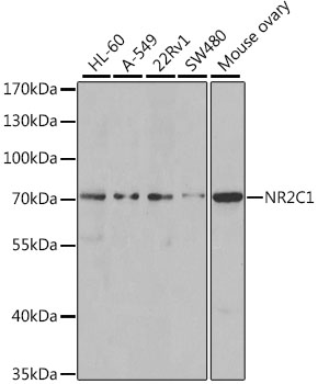Western blot analysis of extracts of various cell lines, using NR2C1 antibody (TA379289) at 1:1000 dilution. - Secondary antibody: HRP Goat Anti-Rabbit IgG (H+L) at 1:10000 dilution. - Lysates/proteins: 25ug per lane. - Blocking buffer: 3% nonfat dry milk in TBST. - Detection: ECL Basic Kit . - Exposure time: 90s.