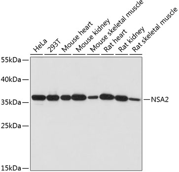 Western blot analysis of extracts of various cell lines, using NSA2 antibody (TA379324) at 1:1000 dilution. - Secondary antibody: HRP Goat Anti-Rabbit IgG (H+L) at 1:10000 dilution. - Lysates/proteins: 25ug per lane. - Blocking buffer: 3% nonfat dry milk in TBST. - Detection: ECL Basic Kit . - Exposure time: 60s.