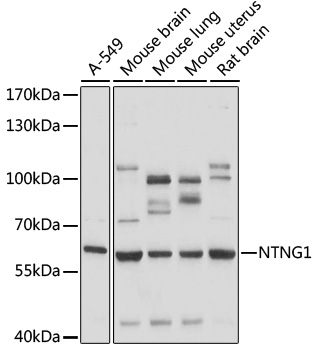 Western blot analysis of extracts of various cell lines, using NTNG1 antibody (TA379368) at 1:1000 dilution. - Secondary antibody: HRP Goat Anti-Rabbit IgG (H+L) at 1:10000 dilution. - Lysates/proteins: 25ug per lane. - Blocking buffer: 3% nonfat dry milk in TBST. - Detection: ECL Basic Kit . - Exposure time: 30s.