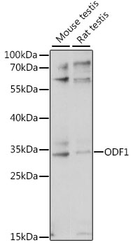 Western blot analysis of extracts of various cell lines, using ODF1 antibody (TA379445) at 1:1000 dilution. - Secondary antibody: HRP Goat Anti-Rabbit IgG (H+L) at 1:10000 dilution. - Lysates/proteins: 25ug per lane. - Blocking buffer: 3% nonfat dry milk in TBST. - Detection: ECL Basic Kit . - Exposure time: 30s.