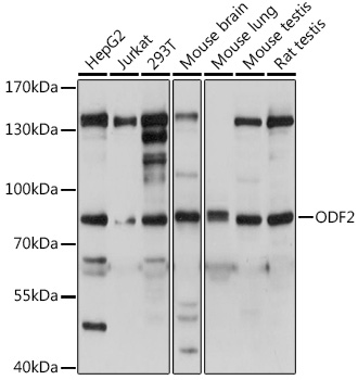 Western blot analysis of extracts of various cell lines, using ODF2 antibody (TA379446) at dilution. - Secondary antibody: HRP Goat Anti-Rabbit IgG (H+L) at 1:10000 dilution. - Lysates/proteins: 25ug per lane. - Blocking buffer: 3% nonfat dry milk in TBST. - Detection: ECL Basic Kit . - Exposure time: 3s.