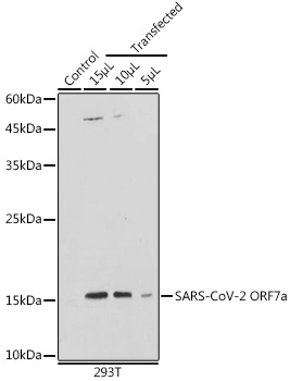 Western blot analysis of extracts of normal 293T cells and 293T transfected with ORF7a Protein, using SARS-CoV-2 ORF7a antibody (TA379502) at 1:1000 dilution. - Secondary antibody: HRP Goat Anti-Rabbit IgG (H+L) at 1:10000 dilution. - Lysates/proteins: 25ug per lane. - Blocking buffer: 3% nonfat dry milk in TBST. - Detection: ECL Basic Kit . - Exposure time: 1s.