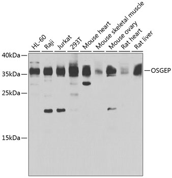 Western blot analysis of extracts of various cell lines, using OSGEP antibody (TA379513) at 1:1000 dilution. - Secondary antibody: HRP Goat Anti-Rabbit IgG (H+L) at 1:10000 dilution. - Lysates/proteins: 25ug per lane. - Blocking buffer: 3% nonfat dry milk in TBST. - Detection: ECL Basic Kit . - Exposure time: 30s.