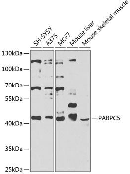 Western blot analysis of extracts of various cell lines, using PABPC5 antibody (TA379566) at 1:1000 dilution. - Secondary antibody: HRP Goat Anti-Rabbit IgG (H+L) at 1:10000 dilution. - Lysates/proteins: 25ug per lane. - Blocking buffer: 3% nonfat dry milk in TBST. - Detection: ECL Basic Kit . - Exposure time: 10s.