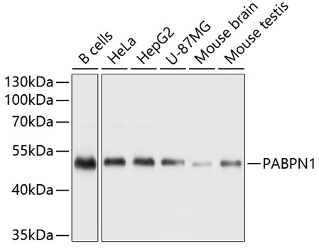 Western blot analysis of extracts of various cell lines, using PABPN1 antibody (TA379567) at 1:1000 dilution. - Secondary antibody: HRP Goat Anti-Rabbit IgG (H+L) at 1:10000 dilution. - Lysates/proteins: 25ug per lane. - Blocking buffer: 3% nonfat dry milk in TBST. - Detection: ECL Basic Kit . - Exposure time: 1s.