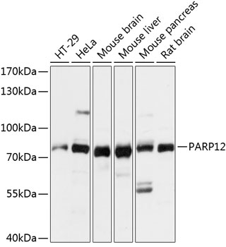 Western blot analysis of extracts of various cell lines, using PARP12 antibody (TA379636) at 1:3000 dilution. - Secondary antibody: HRP Goat Anti-Rabbit IgG (H+L) at 1:10000 dilution. - Lysates/proteins: 25ug per lane. - Blocking buffer: 3% nonfat dry milk in TBST. - Detection: ECL Basic Kit . - Exposure time: 10s.