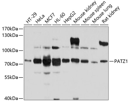 Western blot analysis of extracts of various cell lines, using PATZ1 antibody (TA379649) at 1:1000 dilution. - Secondary antibody: HRP Goat Anti-Rabbit IgG (H+L) at 1:10000 dilution. - Lysates/proteins: 25ug per lane. - Blocking buffer: 3% nonfat dry milk in TBST. - Detection: ECL Basic Kit . - Exposure time: 15s.