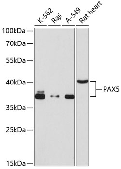 Western blot analysis of recombinant f ull length SARS-CoV-2 N protein (Cat# TP790189, 0.02 ug) by using anti-SARS-CoV-2 N protein antibody (Cat# TA814434). (1:1000)