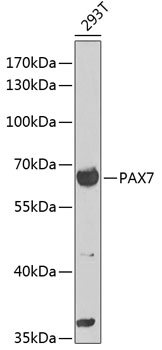 Western blot analysis of recombinant f ull length SARS-CoV-2 N protein (Cat# TP790189, 0.02 ug) by using anti-SARS-CoV-2 N protein antibody (Cat# TA814437). (1:1000)