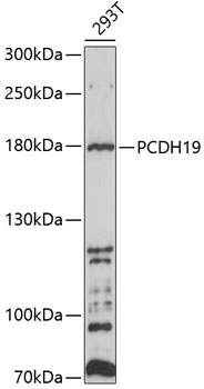 Western blot analysis of  recombinant   SARS-CoV-2 Spike-RBD protein (Cat#TP750182, 0.02 ug) by using anti-SARS-CoV-2 spike protein antibody (TA814463). (1：1000)