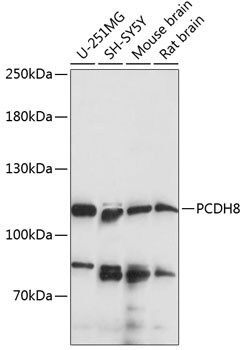 Western blot analysis of  recombinant   SARS-CoV-2 Spike-RBD protein (Cat#TP750182, 0.02 ug) by using anti-SARS-CoV-2 spike protein antibody (TA814466). (1：1000)