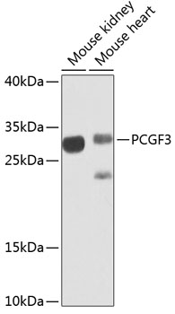 Western blot analysis of extracts of various cell lines, using PCGF3 antibody (TA379691) at 1:1000 dilution._Secondary antibody: HRP Goat Anti-Rabbit IgG (H+L) at 1:10000 dilution._Lysates/proteins: 25ug per lane._Blocking buffer: 3% nonfat dry milk in TBST._Detection: ECL Enhanced Kit ._Exposure time: 30s.