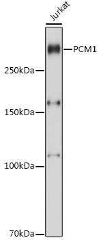 Western blot analysis of extracts of Jurkat cells, using PCM1 antibody (TA379696) at 1:1000 dilution. - Secondary antibody: HRP Goat Anti-Rabbit IgG (H+L) at 1:10000 dilution. - Lysates/proteins: 25ug per lane. - Blocking buffer: 3% nonfat dry milk in TBST. - Detection: ECL Basic Kit . - Exposure time: 10s.