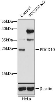 Western blot analysis of f ull length recombinant SARS-CoV-2 N protein (Cat# TP790189, 0.02 ug) by using anti-SARS-CoV-2 N protein antibody (Cat# TA814507).