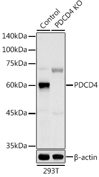 SARS-Cov-2 RBD neutralizing antibody (Cat# TA814512) inhibits human ACE2 protein (Cat# TP701115) binding to SARS-CoV-2 RBD protein TP701119). The IC50 is typically 0.91 nM.